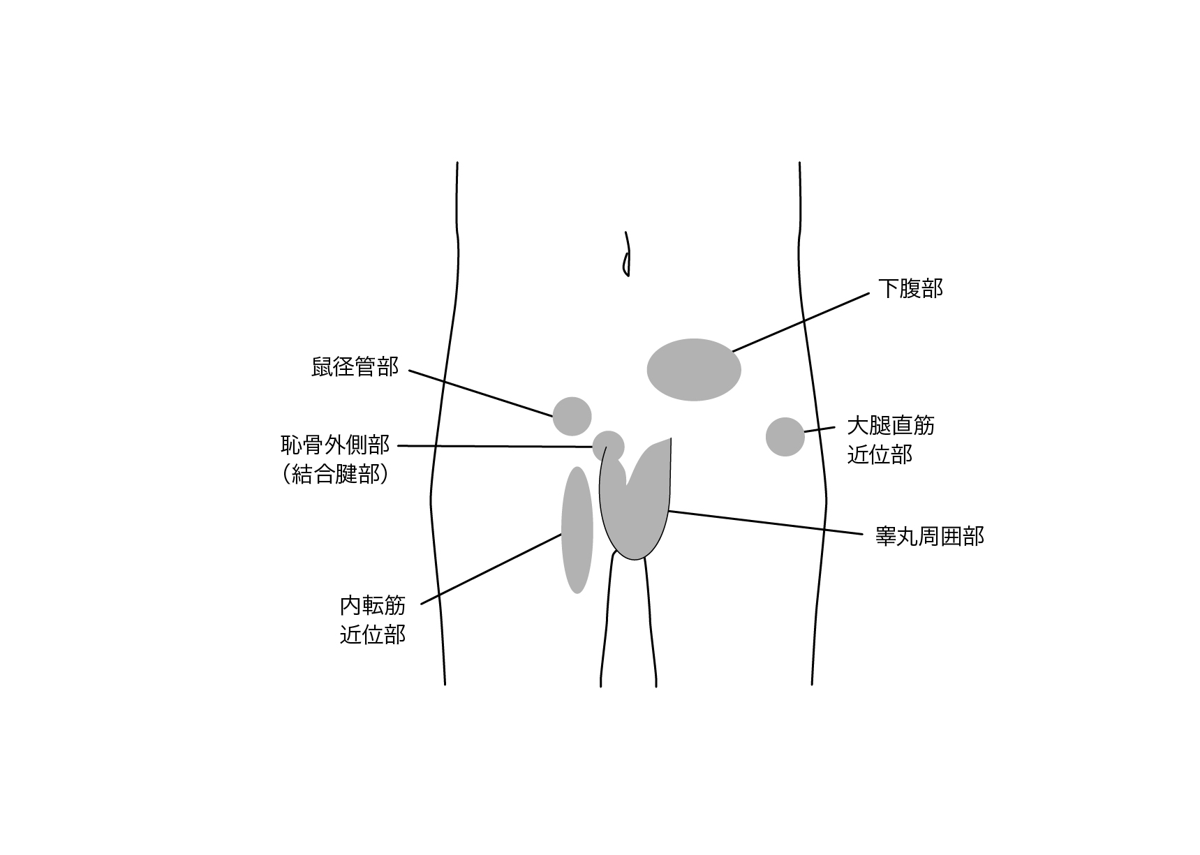 Area of pain around the groin